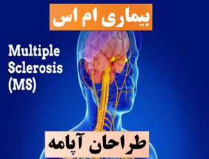 تحقیق ام اس