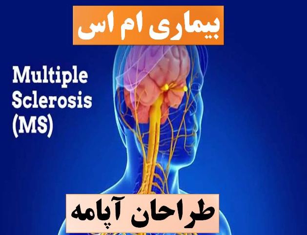 تحقیق ام اس