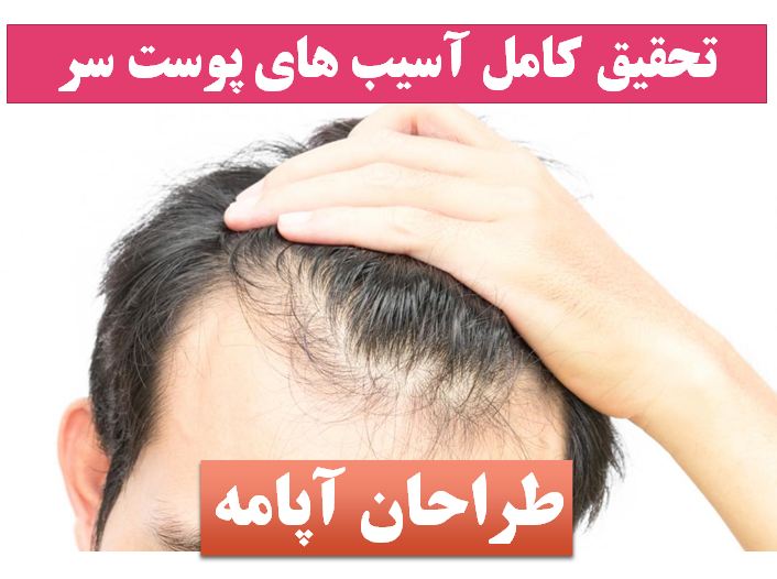 پاورپوینت پوست سر